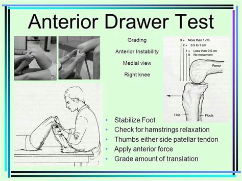 acl tear diagnostic test|lachman's test vs anterior drawer.